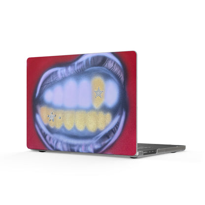 "tooth drip" airbrush matte macbook case